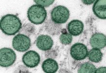 OMS descarta epidemia de hantavirus en crucero