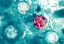 México confirma tres casos de Cyclospora sin brote asociado